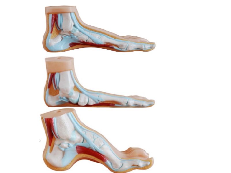 Modelo de Pie Normal, Plano y Arqueado