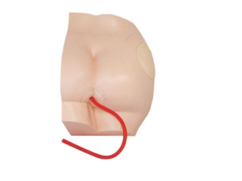 Modelo de Inyecci&oacute;n en Gl&uacute;teos