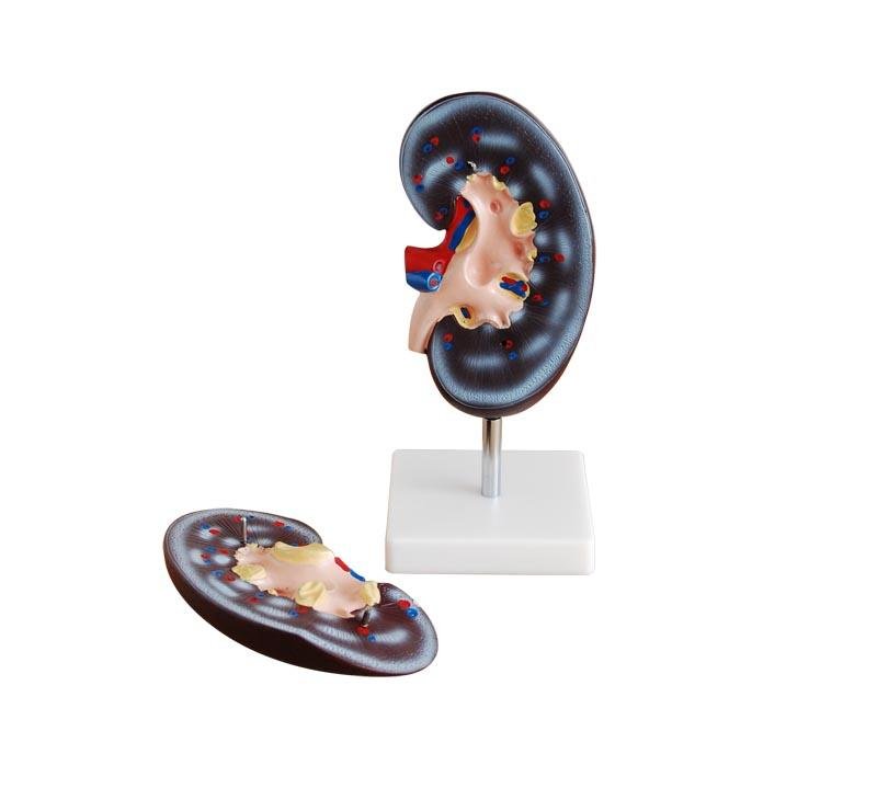 Modelo de Ri&ntilde;&oacute;n en Dos Partes